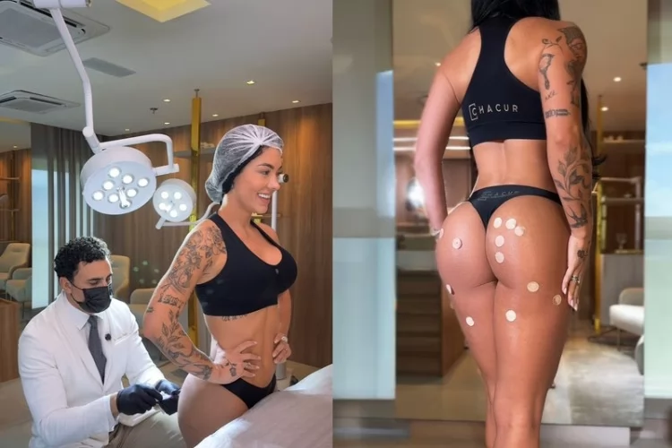 Rayane Figliuzzi diz que médico é o “segundo dono” de seu bumbum, após Belo, e comenta cuidados estéticos