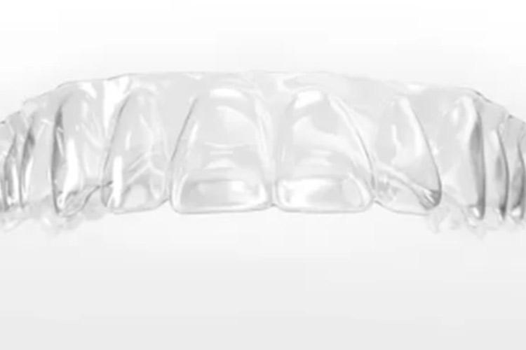5 grandes dúvidas sobre alinhadores transparentes
