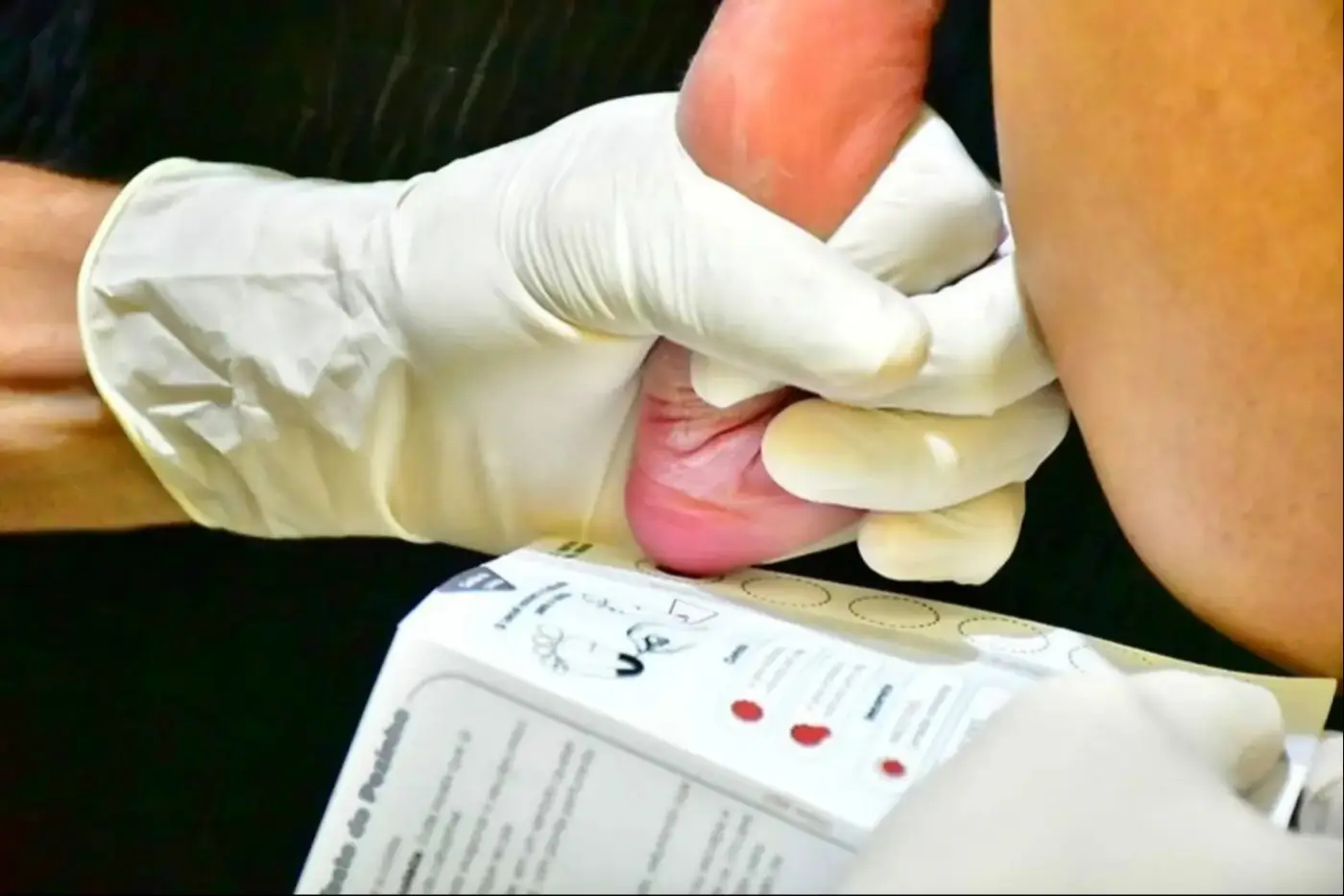 Governo do Amapá garante assistência integral e exames de alta complexidade para pacientes com doença falciforme
