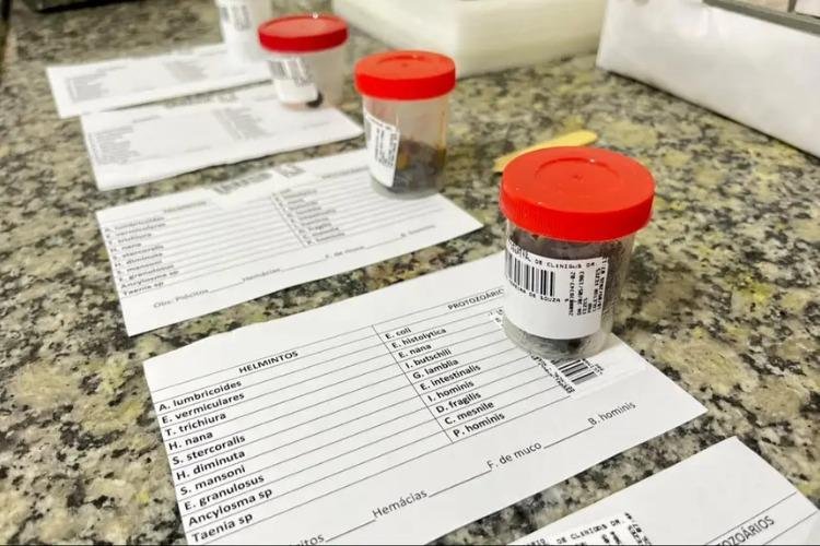 Exames laboratoriais orientam diagnóstico e acompanhamento da evolução do tratamento de pacientes no HCAL
