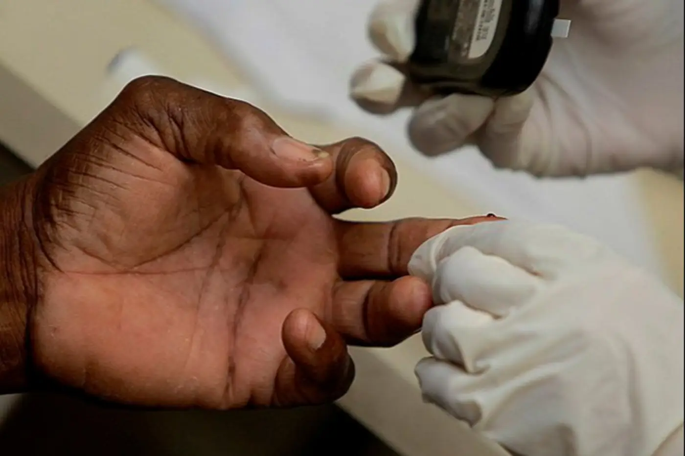 Governo do Amapá alerta para prevenção e cuidados no Dia Nacional do Diabetes