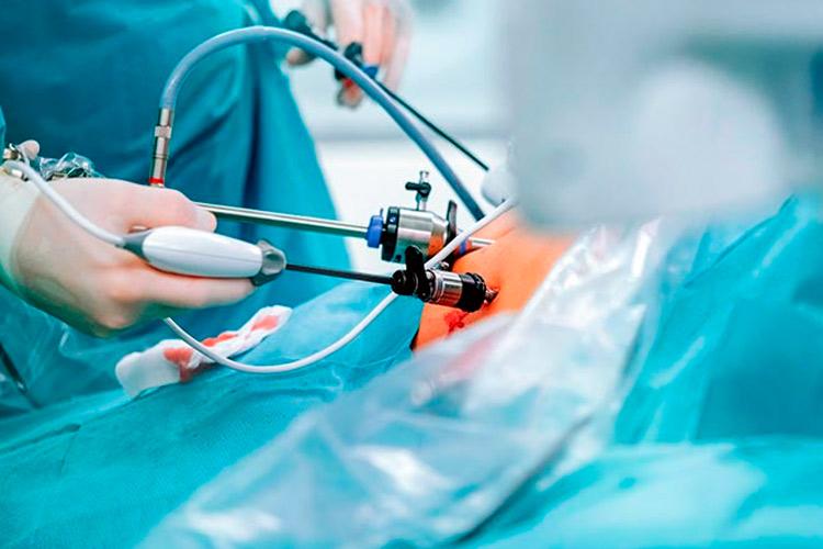 Seis verdades sobre a cirurgia bariátrica