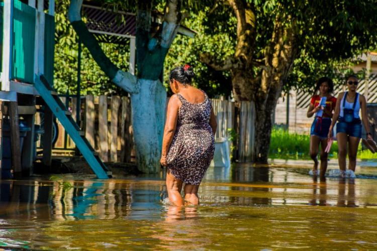 Amapá alerta para risco de contaminação por leptospirose